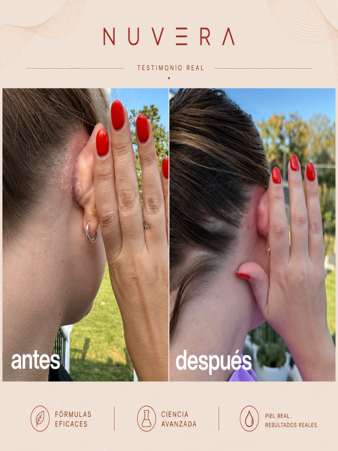 Exfoliante Anti-Caspa