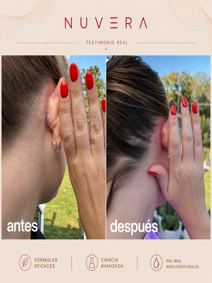 Exfoliante Anti-Caspa